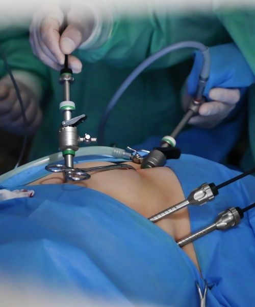 Laparoscopic Surgeries