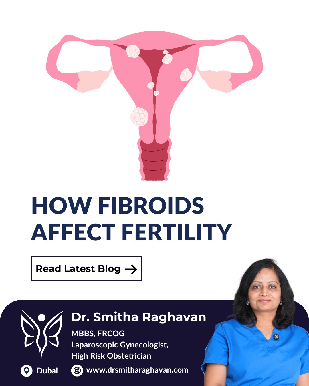 Fibroids treatment in Dubai Dr. Smitha Raghavan, Laparoscopic Gynecologist