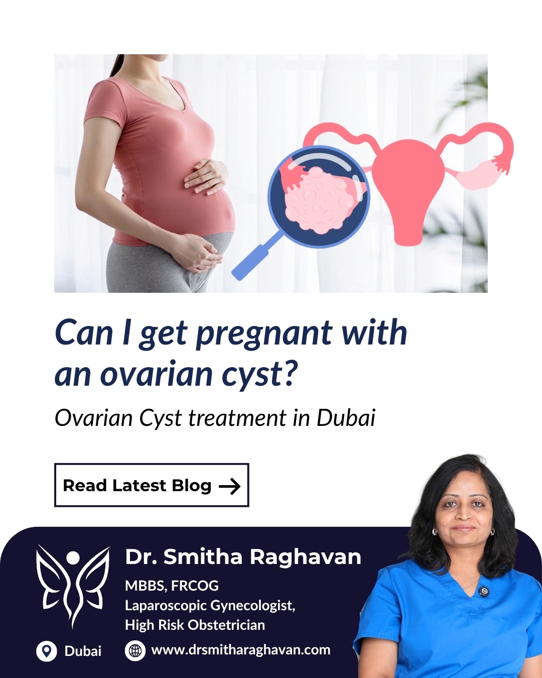 Ovarian Cyst Treatment in Dubai